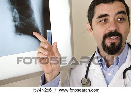 Close-up of a male doctor pointing to an x-ray image View Large Photo Image Stock Photo - Close-up of a male doctor pointing to an x-ray image. Fotosearch