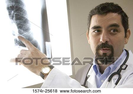 Stock Photo - Close-up of a male doctor pointing to an x-ray image. Fotosearch