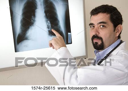 Stock Photography - Portrait of a male doctor pointing to an x-ray image. Fotosearch