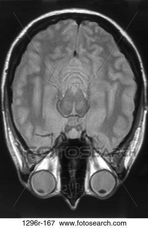 MRI scan of a human brain View Large Photo Image Stock Photo - MRI scan of a human brain. Fotosearch