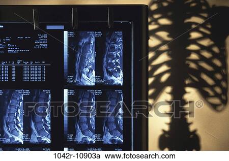 Scans of human spinal cord View Large Photo Image Stock Image - Scans of human spinal cord. Fotosearch