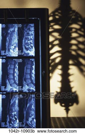 Scans of human spinal cord View Large Photo Image Stock Image - Scans of human spinal cord. Fotosearch