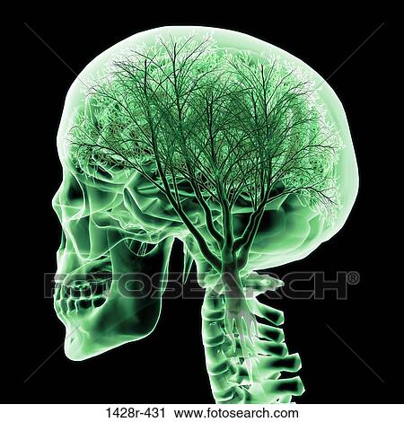 Brain with tree, Digitally Generated Image by Hank Grebe View Large Photo Image Stock Image - Brain with tree, Digitally Generated Image by Hank Grebe. Fotosearch