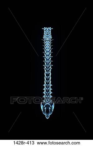 Male human spinal column from rear in blue X-ray by Hank Grebe View Large Photo Image Stock Image - Male human spinal column from rear in blue X-ray by Hank Grebe. Fotosearch