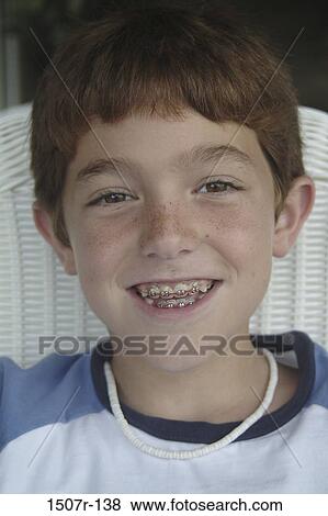 Portrait of a boy smiling with braces View Large Photo Image Stock Photo - Portrait of a boy smiling with braces. Fotosearch