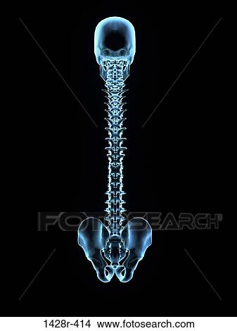 X-Ray of human hip and skull, Digitally Generated Image by Hank Grebe View Large Photo Image Picture - X-Ray of human hip and skull, Digitally Generated Image by Hank Grebe. Fotosearch
