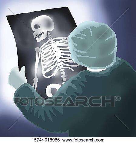 Stock Illustration - The X-Ray 2004 Linda Braucht (20th C. American) Computer graphics. Fotosearch