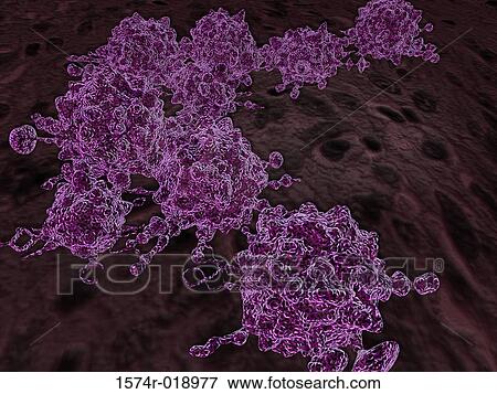 Stock Illustration - Cancer Cells. Fotosearch