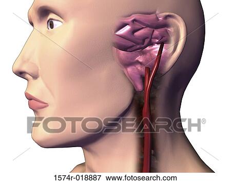Stock Illustration - Carotid Artery. Fotosearch