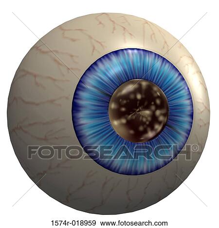 Stock Illustration - Cataract. Fotosearch