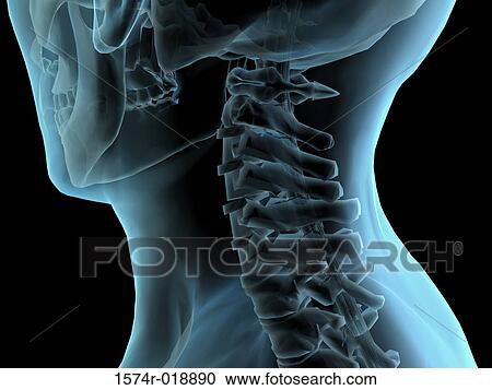 Clipart - Human Neck. Fotosearch