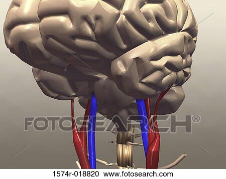 Ischemic Stroke View Large Illustration Clipart - Ischemic Stroke. Fotosearch