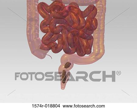 Stock Illustration - Small Intestine Large Intestine. Fotosearch