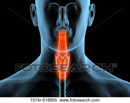 Stock Illustration - Sore Throat. Fotosearch