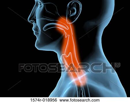 Stock Illustration of Sore Throat 1574r-018956 - Search Clip Art
