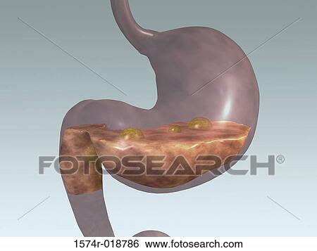 Stomach View Large Illustration Stock Illustration - Stomach. Fotosearch