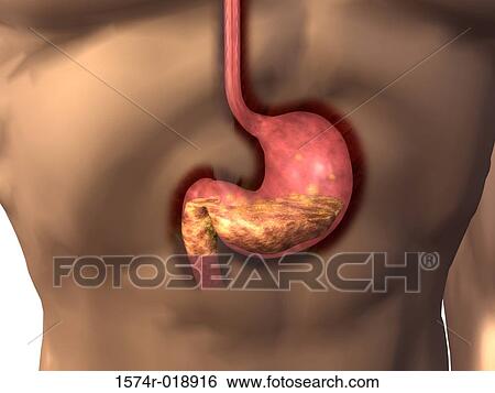 Stomach View Large Illustration Stock Illustration - Stomach. Fotosearch