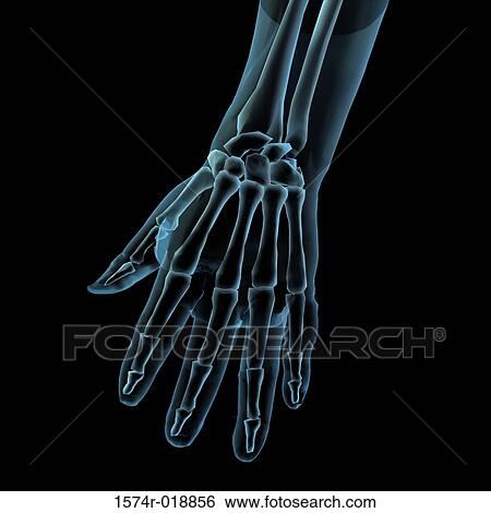 Stock Illustration - X-ray of a hand. Fotosearch
