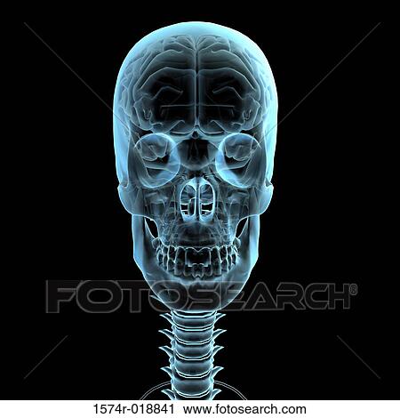 Clip Art - X-ray of a skull. Fotosearch