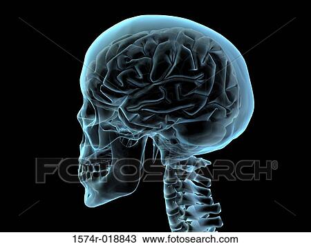 X-ray of a skull View Large Illustration Drawing - X-ray of a skull. Fotosearch