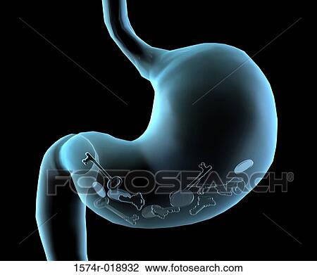 Drawing - X-ray of a stomach. Fotosearch