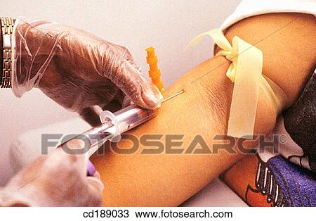 Stock Image - arm, caring, black, action. Fotosearch