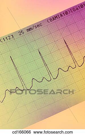 Stock Photograph - ECG strip. Fotosearch