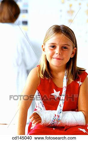 Stock Image - broken, childhood, child, cast, arm. Fotosearch