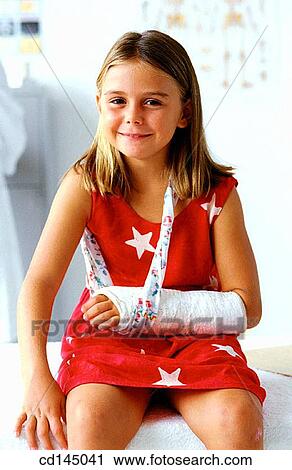 broken, childhood, child, cast, arm View Large Photo Image Stock Image - broken, childhood, child, cast, arm. Fotosearch