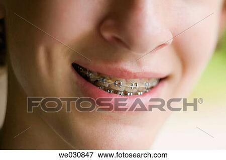 15 year old Caucasian male View Large Photo Image Stock Photo - 15 year old Caucasian male. Fotosearch