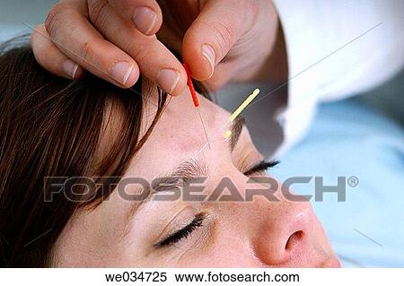 Alternative medicine, Close-up, Chinese medicine, acupuncture View Large Photo Image Stock Photography - Alternative medicine, Close-up, Chinese medicine, acupuncture. Fotosearch