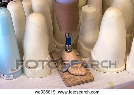 Artificial limb with positive models, residual limb models with prosthesis, replacement limb with casts View Large Photo Image Stock Photo - Artificial limb with positive models, residual limb models with prosthesis, replacement limb with casts. Fotosearch