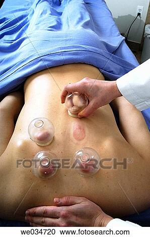 Cupping View Large Photo Image Stock Image - Cupping. Fotosearch