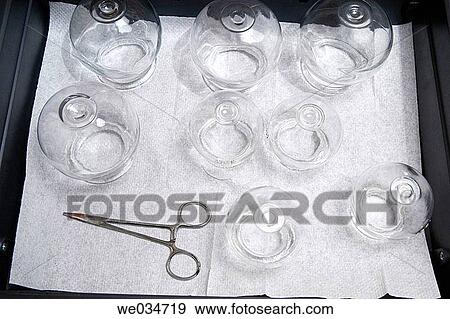 Cupping View Large Photo Image Stock Photo - Cupping. Fotosearch