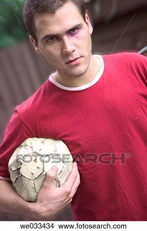 Picture - Man with bruised eye holding a soccer ball. Fotosearch