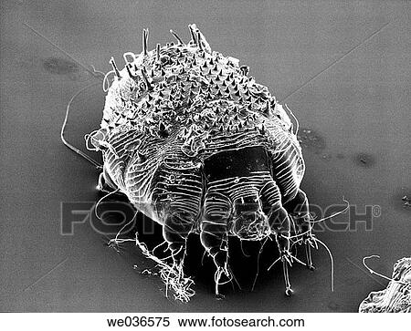 Mite, scabies, itch (photo taken with an electron microscope) View Large Photo Image Stock Photography - Mite, scabies, itch (photo taken with an electron microscope). Fotosearch