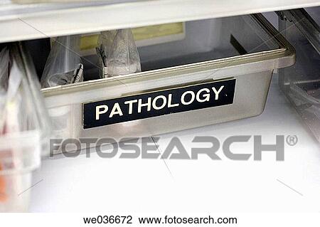 Pathology tray in hospital lab View Large Photo Image Stock Image - Pathology tray in hospital lab. Fotosearch