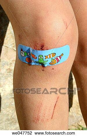 Bandaid on knee View Large Photo Image Stock Image - Bandaid on knee. Fotosearch