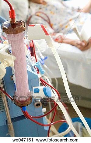Stock Image - Dialyzer or artificial kidney used to filter blood during hemodialysis session. Fotosearch