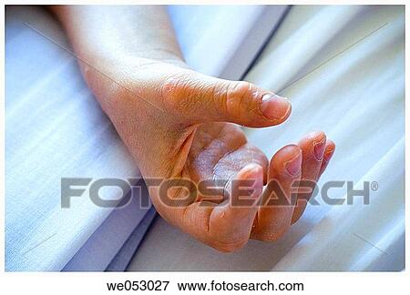 Stock Photo - bed, Close-up, detail, disease. Fotosearch
