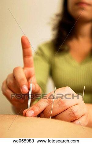 Acupuncture View Large Photo Image Stock Image - Acupuncture. Fotosearch
