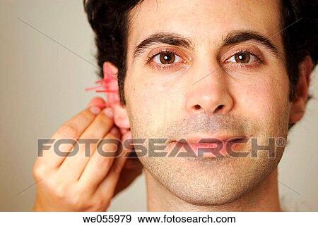 Acupuncture View Large Photo Image Stock Photo - Acupuncture. Fotosearch