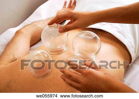 Cupping View Large Photo Image Picture - Cupping. Fotosearch