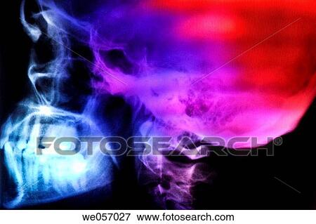 X-ray View Large Photo Image Stock Photo - X-ray. Fotosearch