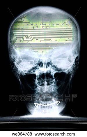 Cranium, skull, x-ray, robot View Large Photo Image Stock Photo - Cranium, skull, x-ray, robot. Fotosearch