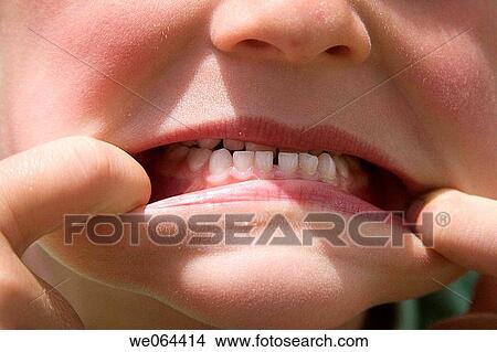 close up of an open childs mouth, with white shiny teeth View Large Photo Image Picture - close up of an open childs mouth, with white shiny teeth. Fotosearch