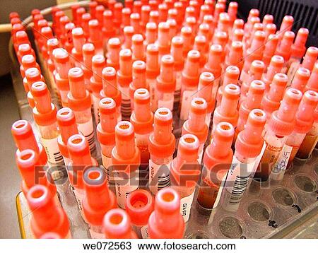 blood, Blood analysis, Blood test, haemoglobin, hemoglobin View Large Photo Image Stock Image - blood, Blood analysis, Blood test, haemoglobin, hemoglobin. Fotosearch
