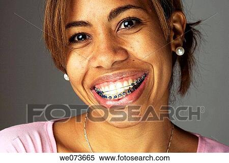Stock Photography - Latin girl with braces. Fotosearch