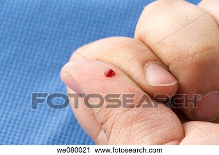 Drop of blood on a recently pinched thumb View Large Photo Image Stock Image - Drop of blood on a recently pinched thumb. Fotosearch