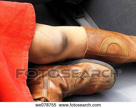 Girl's knee View Large Photo Image Stock Photography - Girl's knee. Fotosearch